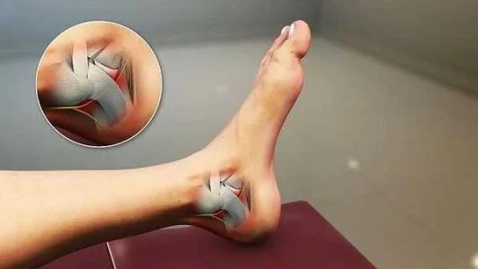 علت درد پاشنه چیست و چگونه درمان می شود؟