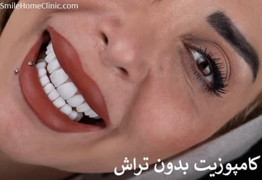 مرکز ونیر کامپوزیت شمال تهران دکتر شبنم کرمی