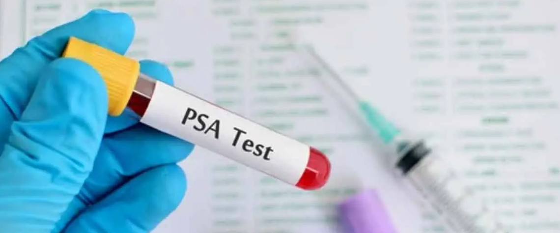 چکاپ پروستات بدون درد در کلینیک های معتبر