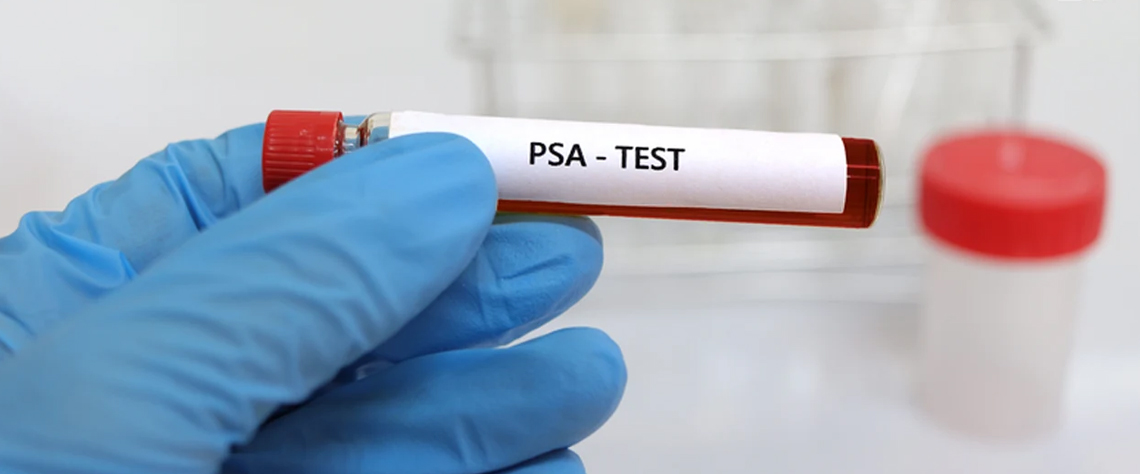 بیماری | آزمایش نحوه آمادگی برای انجام چکاپ پروستات بدون درد